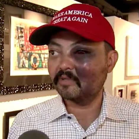 CITY OF RAGE: Group of 15 Teens Severely Beat Manhattan Shop Owner for Wearing ‘MAGA’ Hat
